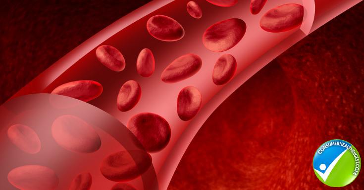 Iron Deficiency Anemia