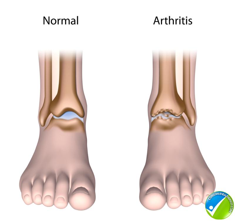 most common symptoms