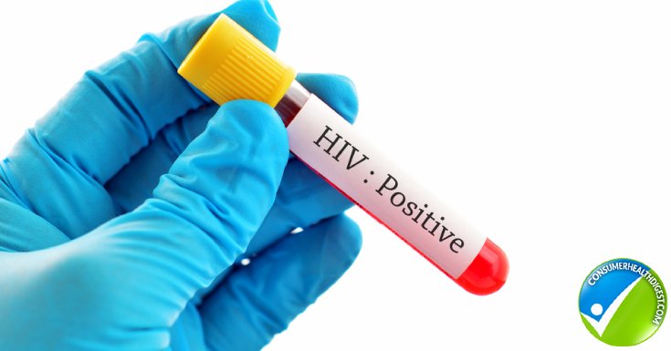 Hiv Blood Sample