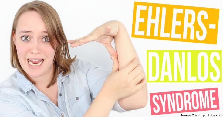 Ehlers-Danlos