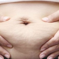 Banish the Mummy Tummy