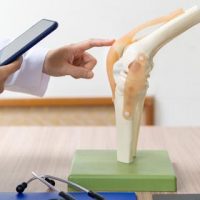 PRP/Stem Cell Therapy vs. Cortisone & Surgery