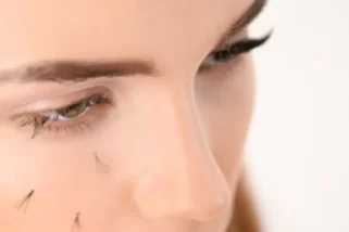 Eyelashes Falling Out – What Are The Causes & Treatment?