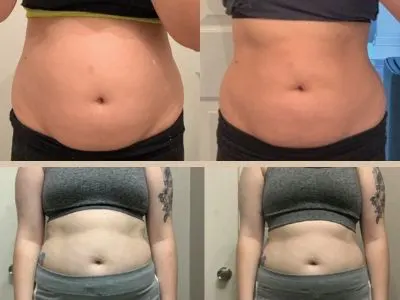 ThermoFight X before and after