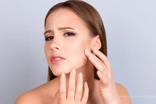 All You Need To Know About Acne Treatments