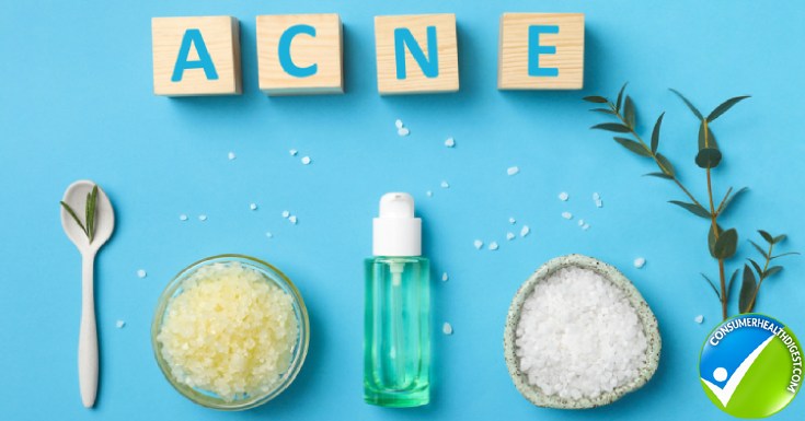 Acne Prevention