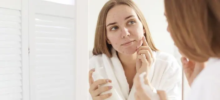 Acne Products
