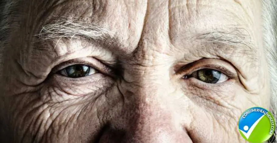 Aging