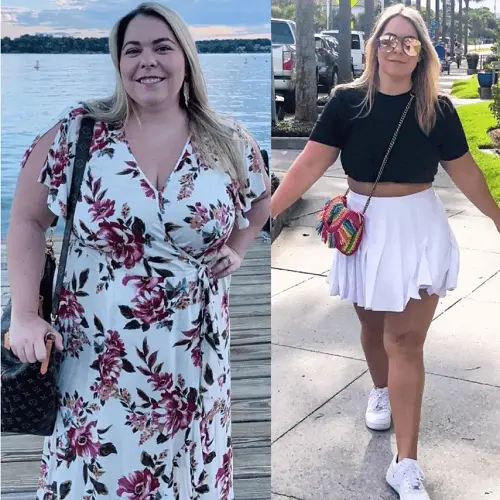 Before and After Weight Loss Results with FuturHealth