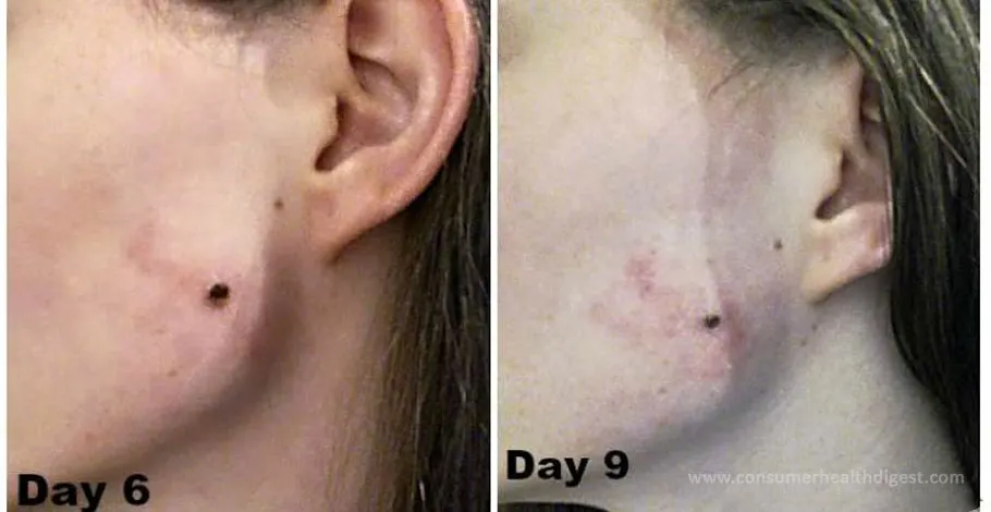 Apple Cider Vinegar Works