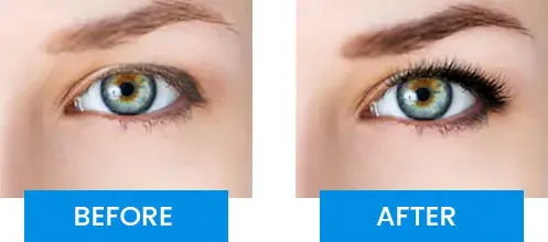 Bioluma Before After