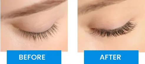 Bioluma Before After
