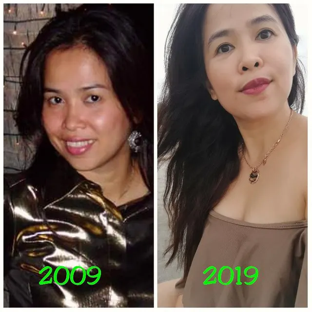  Biotulin supreme skin gel Before and After Pictures