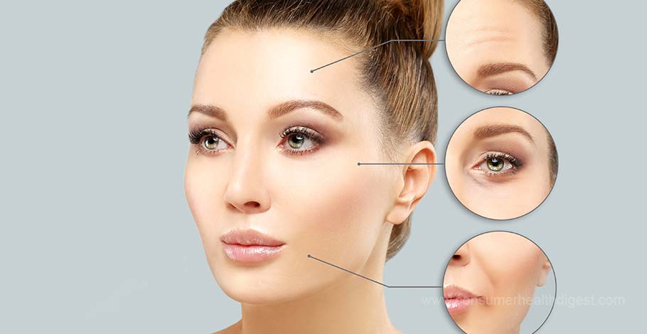 Botox injected