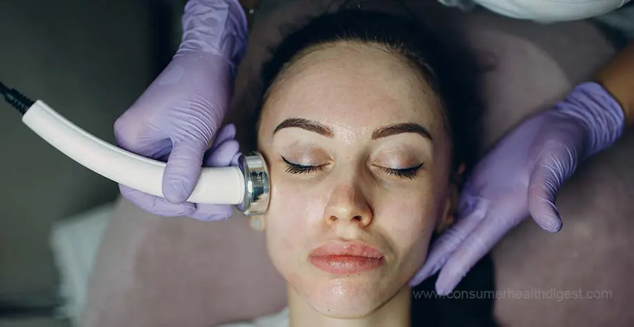 Can I get microdermabrasion for my skin