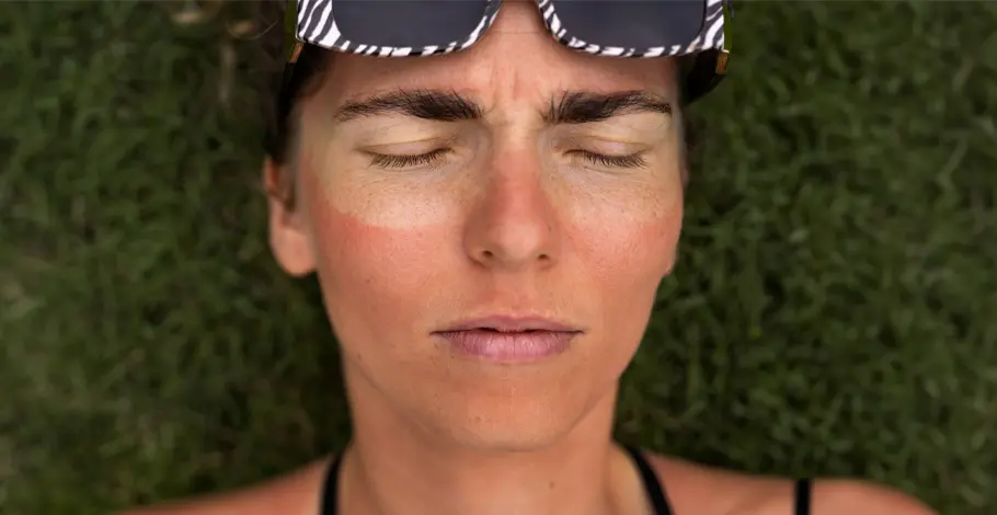 Causes of Hyperpigmentation