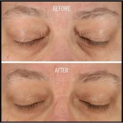 Celestolite’s Before and After