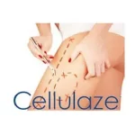 Cellulaze Reviews: Does It Really Work As Advertised?