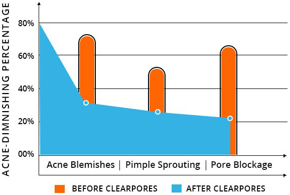 Clear Pores Acne Treatment Graph