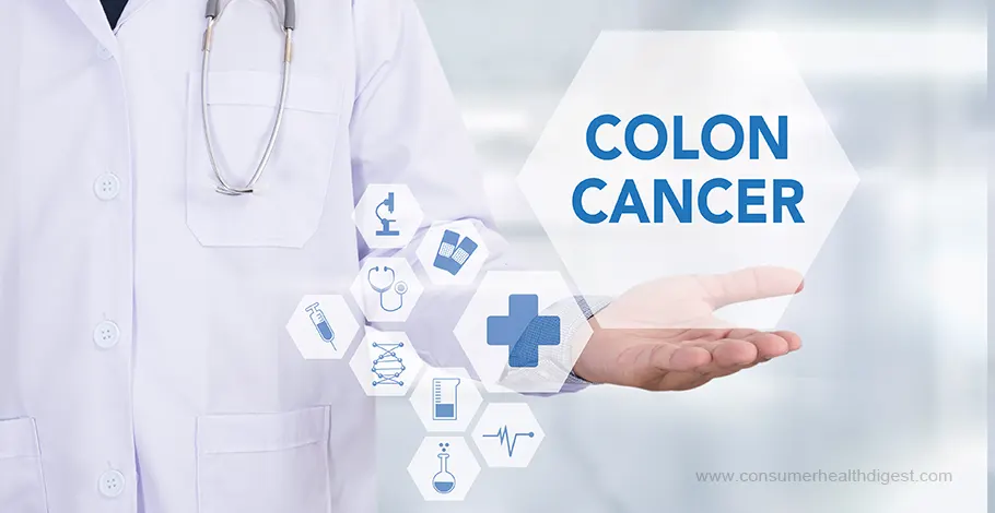 Colon Cancer: Causes, Symptoms, and Treatment
