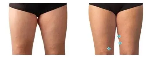 dermatic effects before and after
