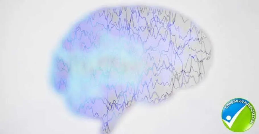 Epilepsy Cause