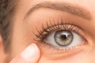 Eyelash Growth Abnormalities – Causes and Expert Solution!