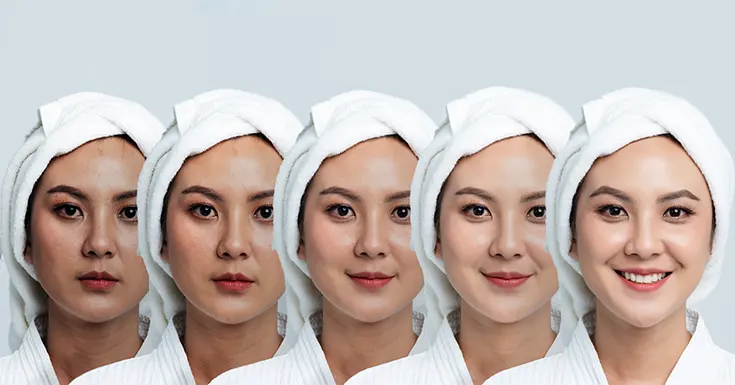 fade dark spots, hyperpigmentation, and post-acne marks