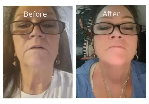 GoPure Straffende und Liftende Halscreme – Vorher-Nachher-Ergebnis