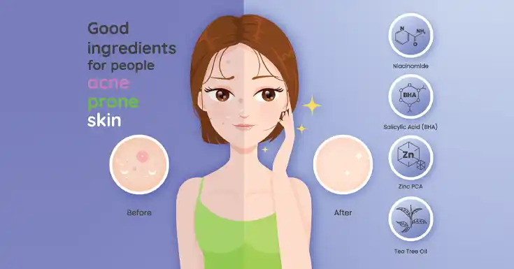 ingredients for acne prone skin
