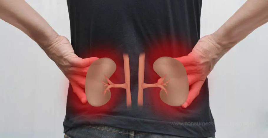 Kidney Failure