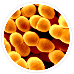 Lactococcus lactis