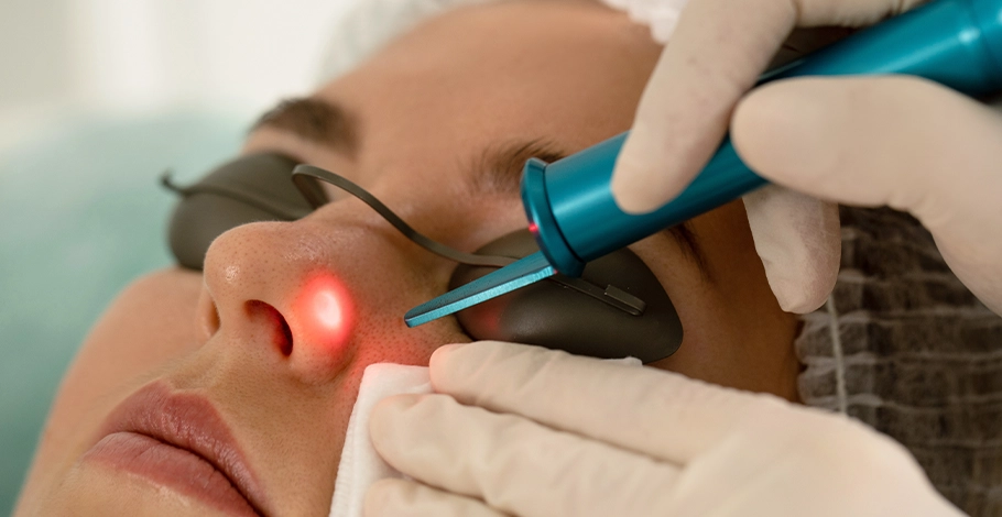 Laser treatments