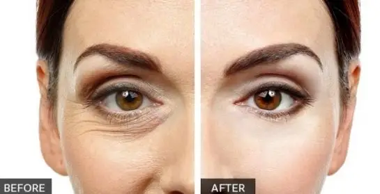 Lift Factor Plus Skin Result