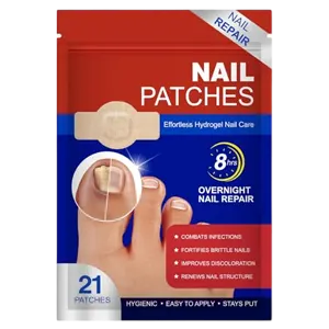 LTQXGT Nagelpilzflecken