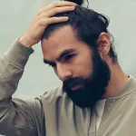 Men’s hair problems: what can you do when your hair has lost its beauty?