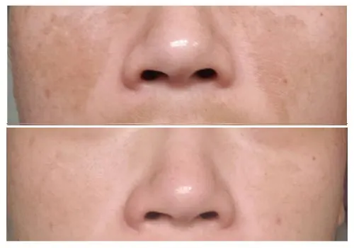  Before and After Customer Result