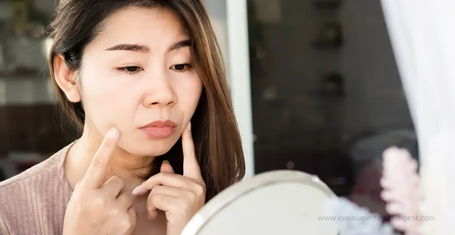 Nasolabial Folds
