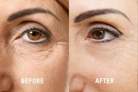 Nourishmax Before and After