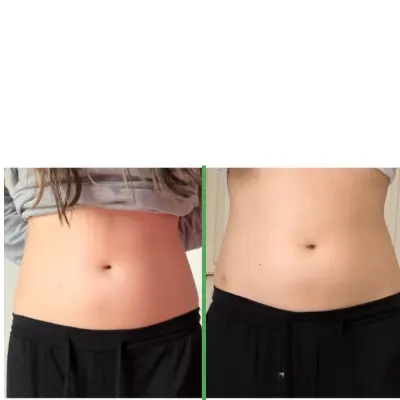 nushape-lipo-wrap - before and after image