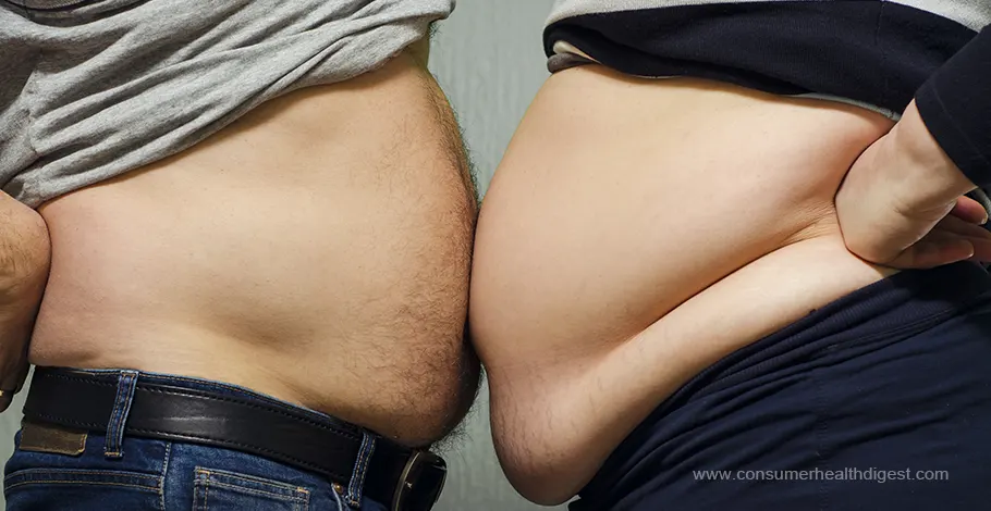 Obesity Facts, Symptoms, Causes, and How to Overcome It?