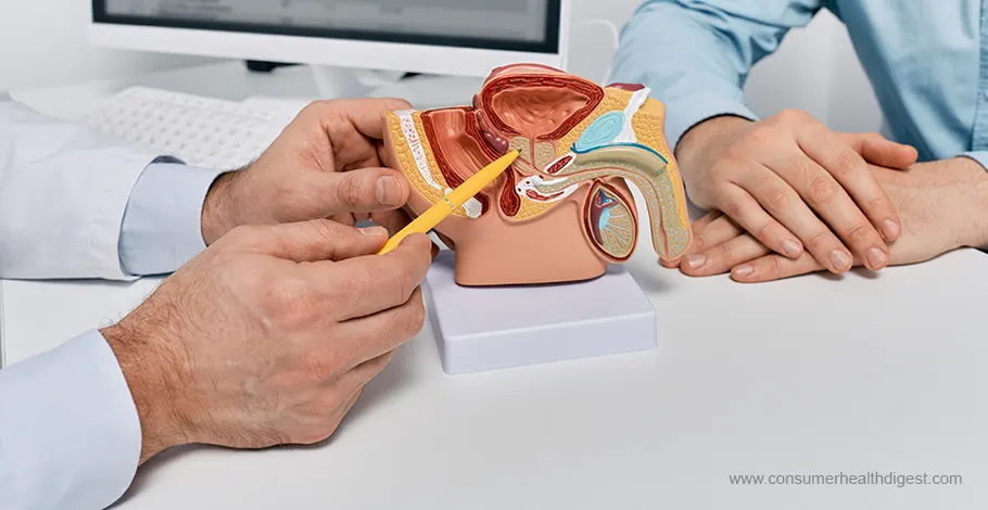 prostate-cancer-types-symptoms-causes-diagnosis-and-treatment