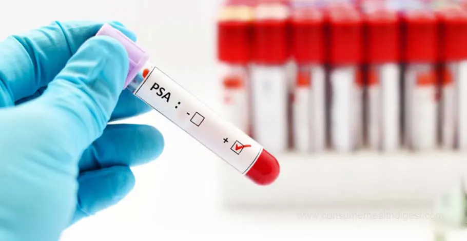 Prostate Cancer