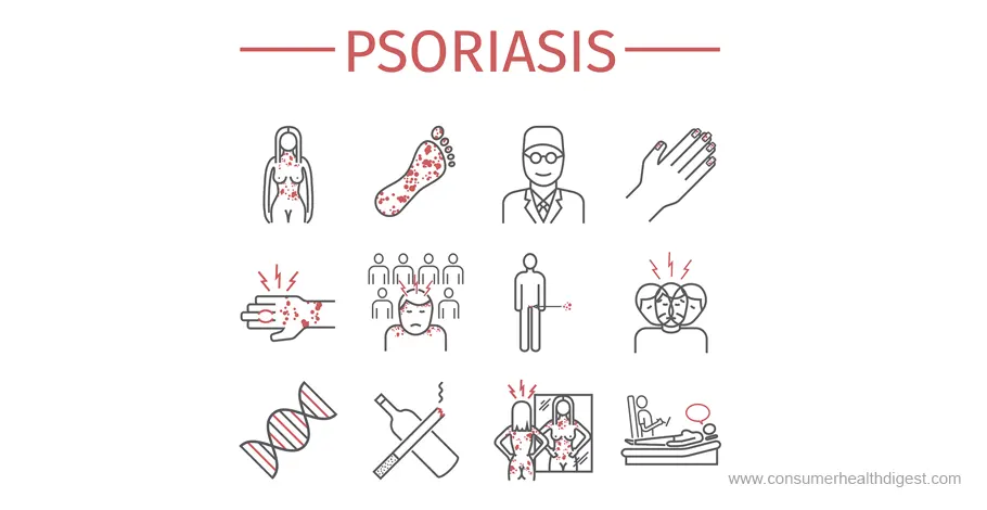 Psoriasis-Arthritis