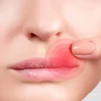 red-ring-around-my_lips