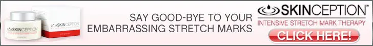 skinception stretch mark