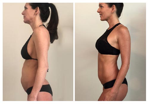 Before and After Results