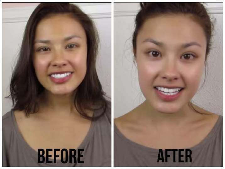 Snow White Cream Before and After Pictures