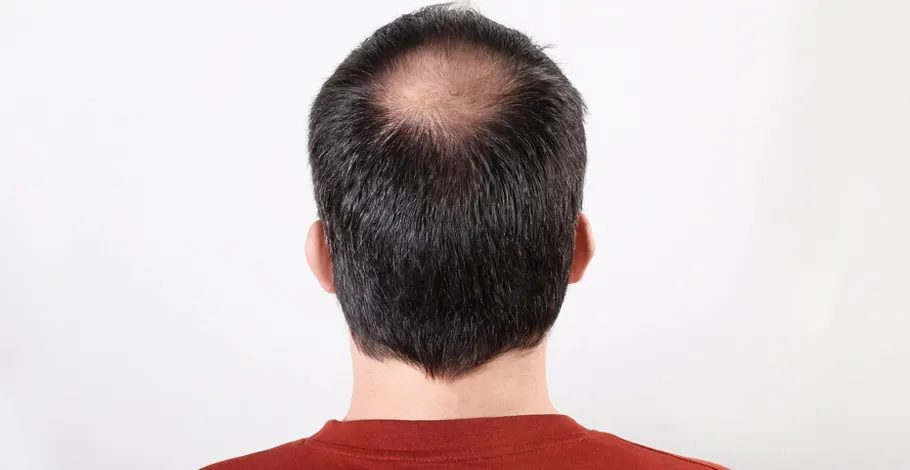Symptoms and early signs