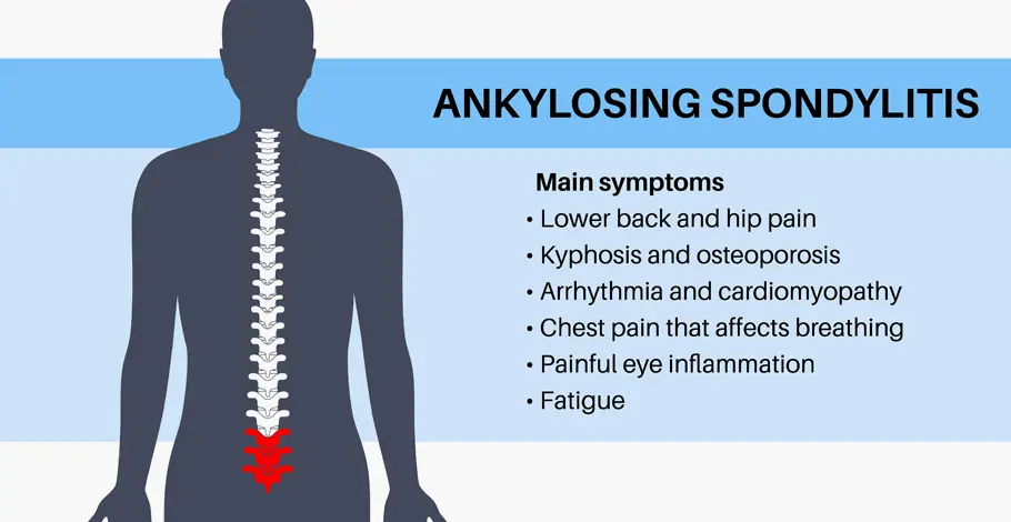 Ankylosing Spondylitis Symptoms